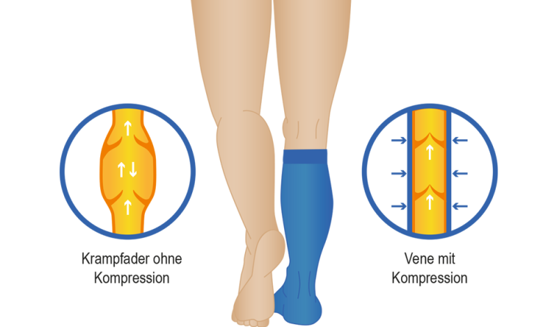 FITLEGS Sport-Kompressionsstrümpfe – erhöht die Durchblutung, reduziert  Muskelermüdung und Muskelkater – verbessert die Erholungszeit,  Schwarz/Stahlgrau, L : : Fashion